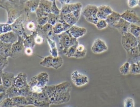 MCF-7Adr细胞（人乳腺癌阿霉素耐药细胞株MCF7亚株）