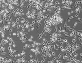 CAL62细胞系（人未分化甲状腺癌细胞系） 