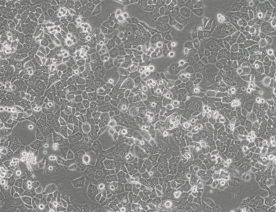 NCI-H2126细胞（人肺癌细胞）