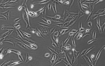 HKF细胞（人瘢痕疙瘩成纤维细胞SV40永生化）