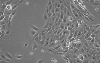 MCF 10A细胞的推荐生长和培养条件是什么？