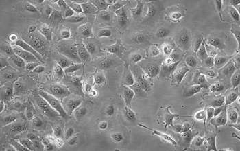 caki-2细胞系（人肾透明细胞癌细胞系、乳头状肾细胞癌细胞）