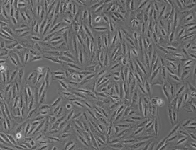 ktc-1细胞（人甲状腺癌细胞系）