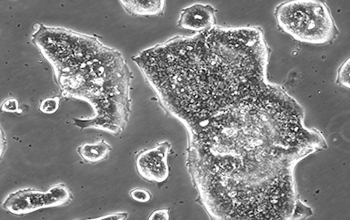 LS174T细胞（人结肠腺癌细胞）