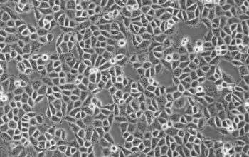 95C细胞【人肺巨细胞癌细胞(低转移)】