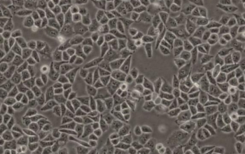 A2780细胞－人卵巢癌细胞系