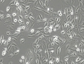 FTC-133细胞（人滤泡状甲状腺癌细胞）