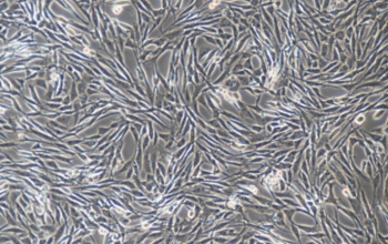 胶质瘤细胞裸鼠成瘤模型