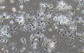 大鼠下丘脑神经元细胞（原代细胞）