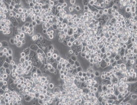 MDA-kb2细胞（人乳腺癌细胞系）