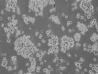 NCI-H716细胞系 (人结直肠腺癌细胞系)