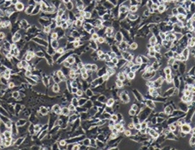 PATU 8988S人胰腺癌细胞