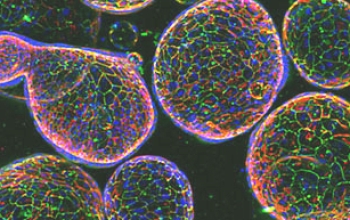 人淋巴母细胞的免疫功能及应用