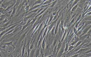 人软骨细胞系（原代软骨细胞）