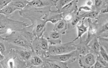 TJ905细胞（人胶质瘤细胞）