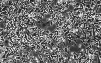 SHZ-88 大鼠乳腺癌细胞