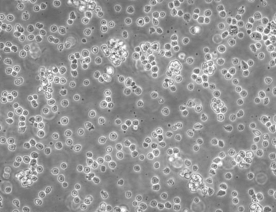 SUPB15细胞（人Ph+急淋白血病细胞）