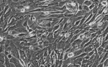 原代小鼠骨髓间充质干细胞（bmscs细胞）