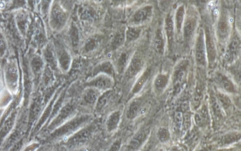 HMEC-1细胞（人真皮微血管内皮细胞，原代细胞）