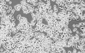 MKN-45细胞（人胃癌细胞）