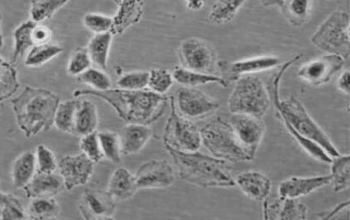 HBE135-E6E7人支气管上皮细胞