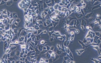 HepG2人肝癌细胞